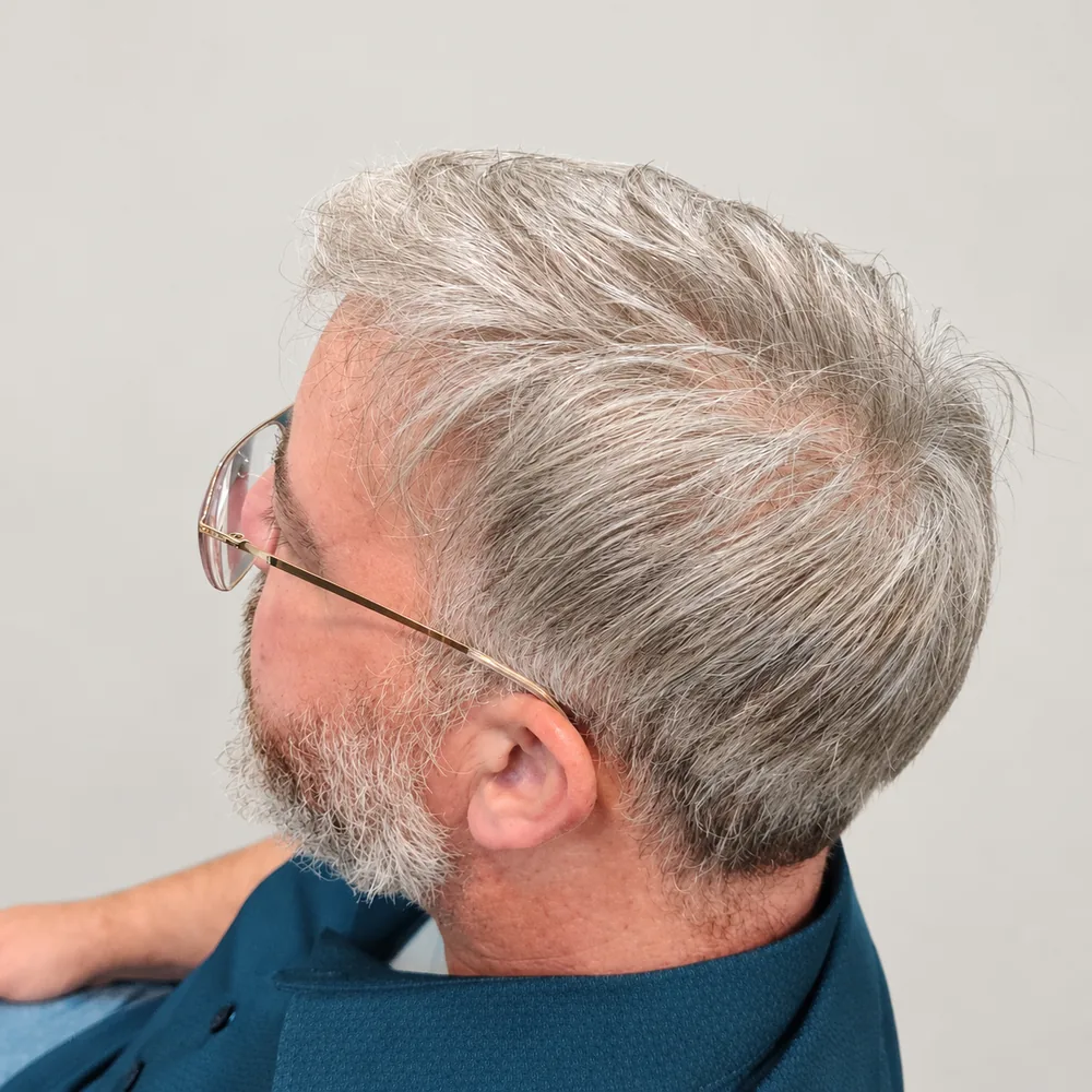 Real HEADS client — full grey hair system swept to the side, seen from above
