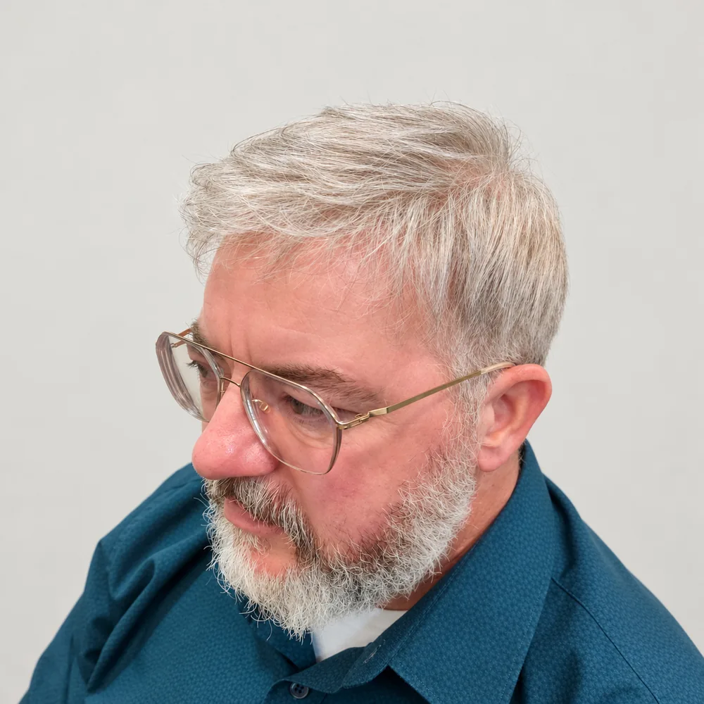 Real HEADS client — salt-and-pepper hair system matched to his grey beard, three-quarter view