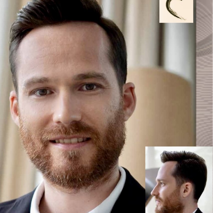Real HEADS client — natural hairline and full hair with his hair system